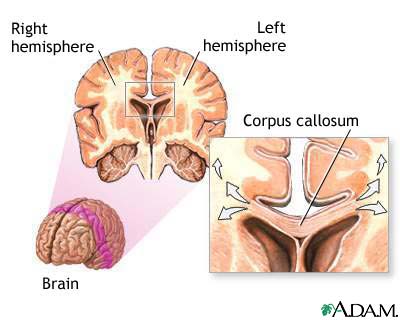 http://www.health32.com/wp-content/uploads/2010/11/corpus-callosum-of-the-brain.jpg